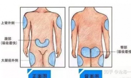 胰岛素注射视频教程,轻松掌握注射技巧与注意事项